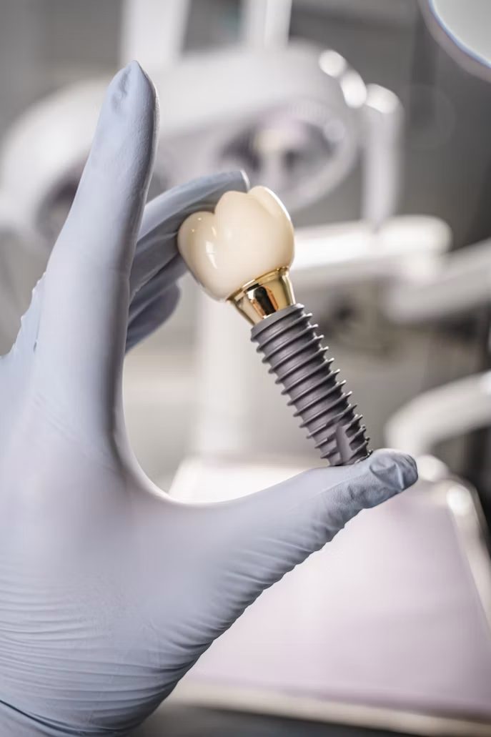 Un implant dentaire et sa couronne tenus dans une main gantée
