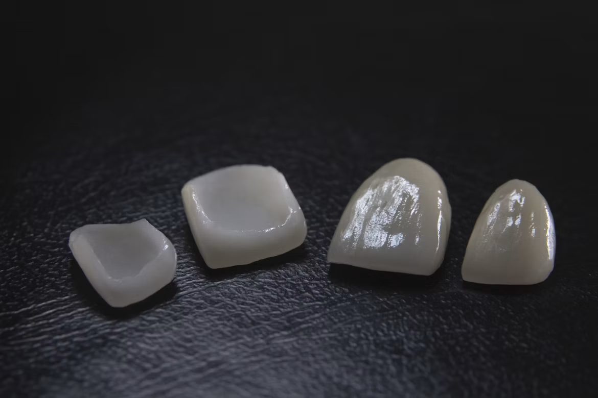 Quatre facettes en céramique alignées sur un fond sombre
