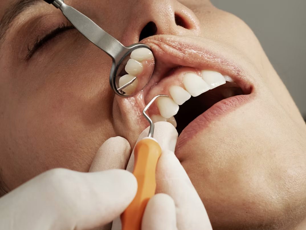 Examen minutieux des dents et des gencives